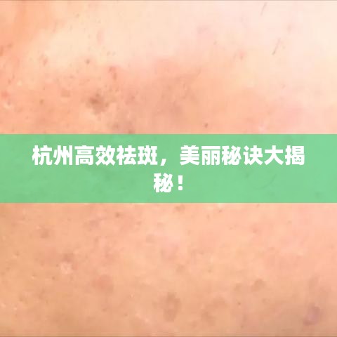杭州高效祛斑，美麗秘訣大揭秘！
