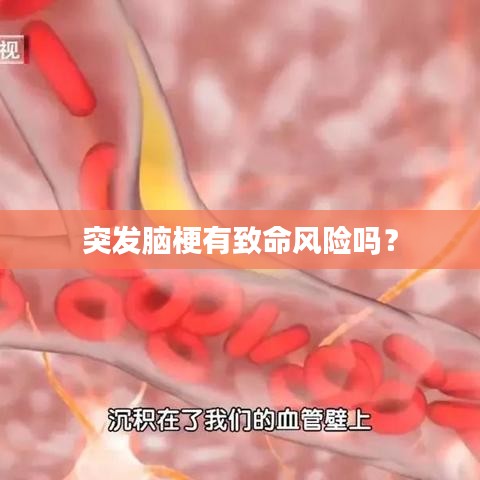突發(fā)腦梗有致命風(fēng)險(xiǎn)嗎？