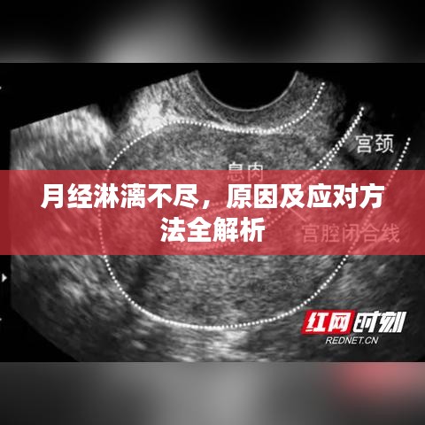 月經(jīng)淋漓不盡，原因及應(yīng)對方法全解析